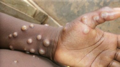 Morocco Sees First Mpox Case in North Africa During Emergency – CDC